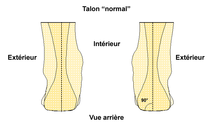 Pathologies Valgus calcan en